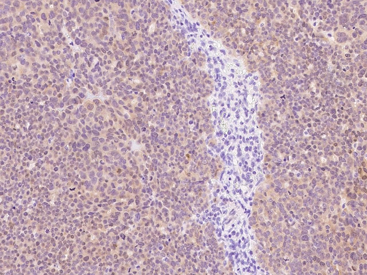 P2RY6 / P2Y6 Antibody (Preservative Free)