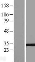 TM4SF9 / TSPAN5 Protein (Over-Expression Lysate Myc-DDK (Flag))