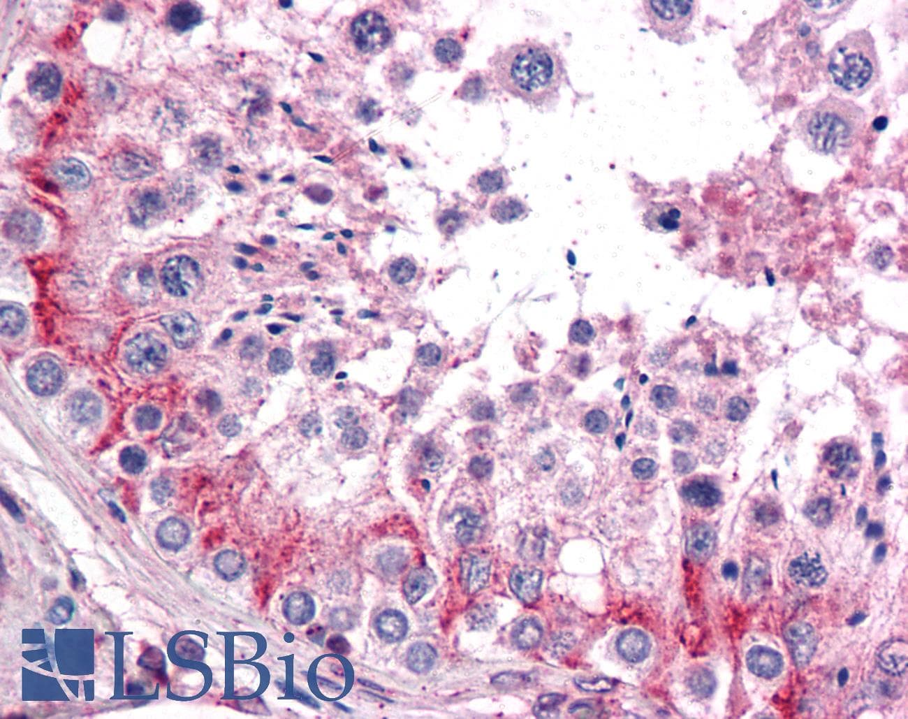 IHC-plus™ TLN1 / Talin 1 Antibody (clone 2E10)