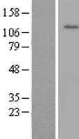 WDR72 Protein (Over-Expression Lysate Myc-DDK (Flag))