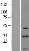 SARNP / Hcc-1 / CIP29 Protein (Over-Expression Lysate Myc-DDK (Flag))