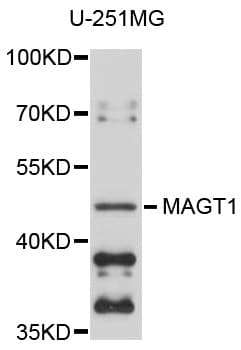 Polyclonal Rabbit anti-Human MAGT1 Antibody (WB)