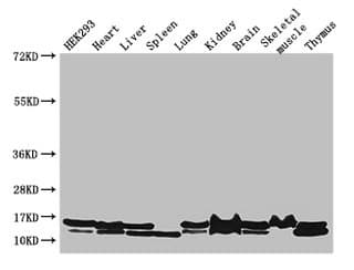 Polyclonal Rabbit anti-Human NDUFB6 Antibody