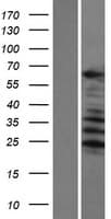 C1orf116 Protein (Over-Expression Lysate Myc-DDK (Flag))