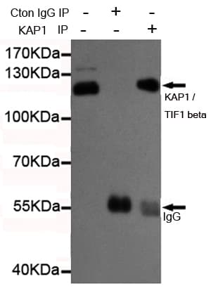 Monoclonal Mouse anti-Human TRIM28 / KAP1 Antibody (IHC, WB)