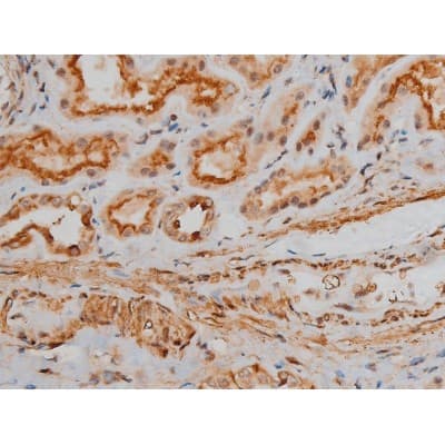 CREB1 / CREB Antibody (phospho-Ser133)