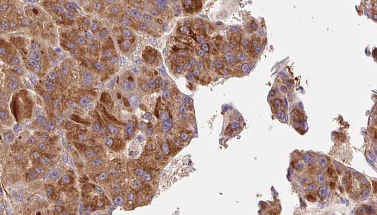 Polyclonal Rabbit anti-Human TACR1 / NK1R Antibody (IHC, IF, WB)