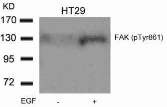 FAK / Focal Adhesion Kinase Antibody