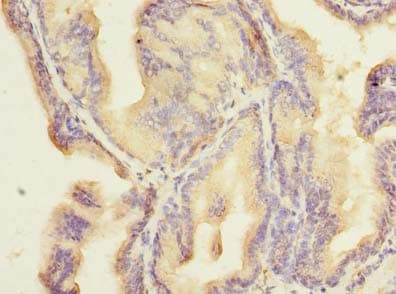 ZNF614 Antibody