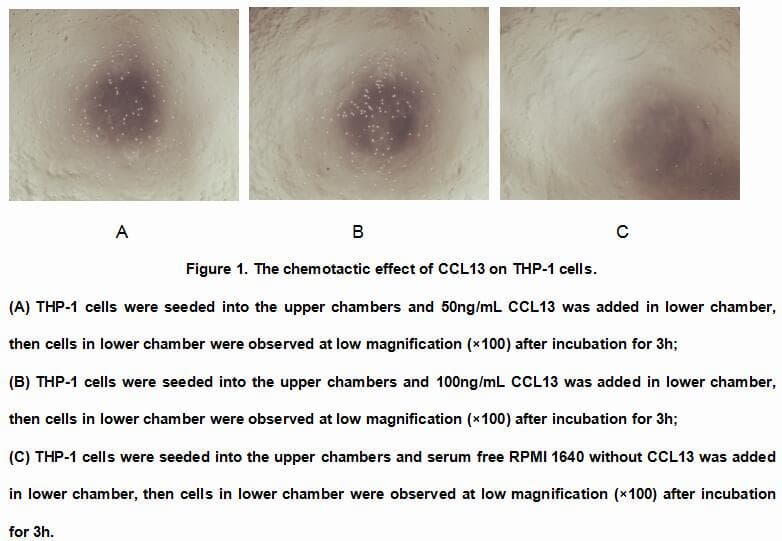 Human DKK1 Protein (Recombinant His, N-Terminal)