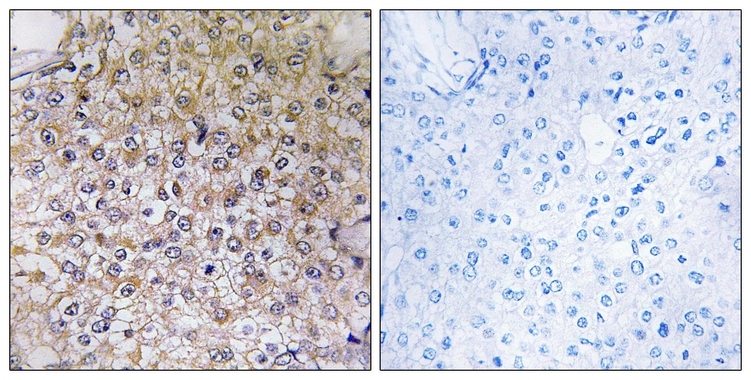 ATP6V1B1 Antibody
