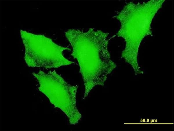 IHC-plus™ Monoclonal Mouse anti-Human FOXO3 / FOXO3A Antibody (clone 2H2, IHC, IF, WB)