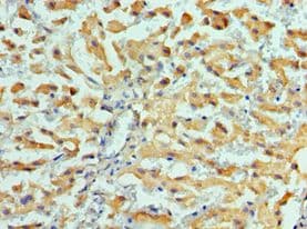 HSPH1 / HSP105 Antibody (aa659-858)