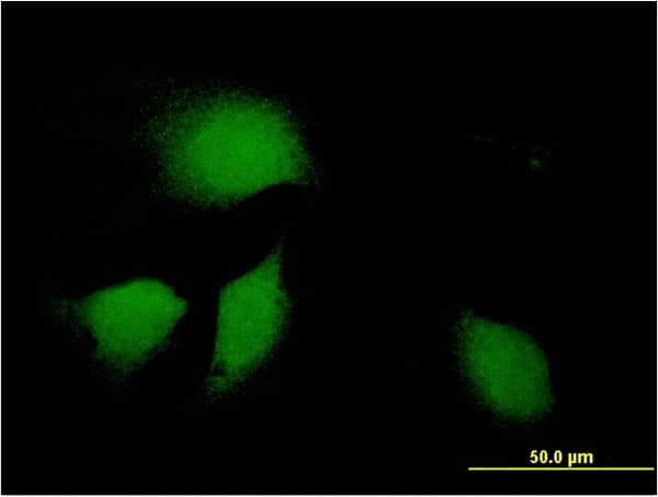 Monoclonal Mouse anti-Human ERdj4 / DNAJB9 Antibody (clone 3G4, IF)