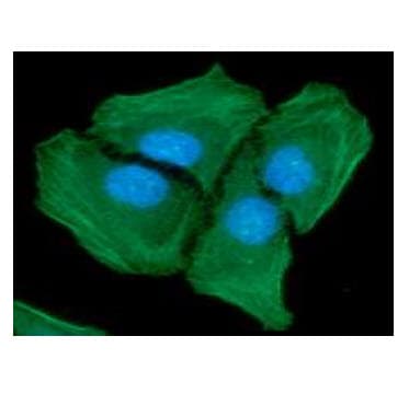 PathPlus™ ACTA2 / Smooth Muscle Actin Antibody (clone AT132D3)