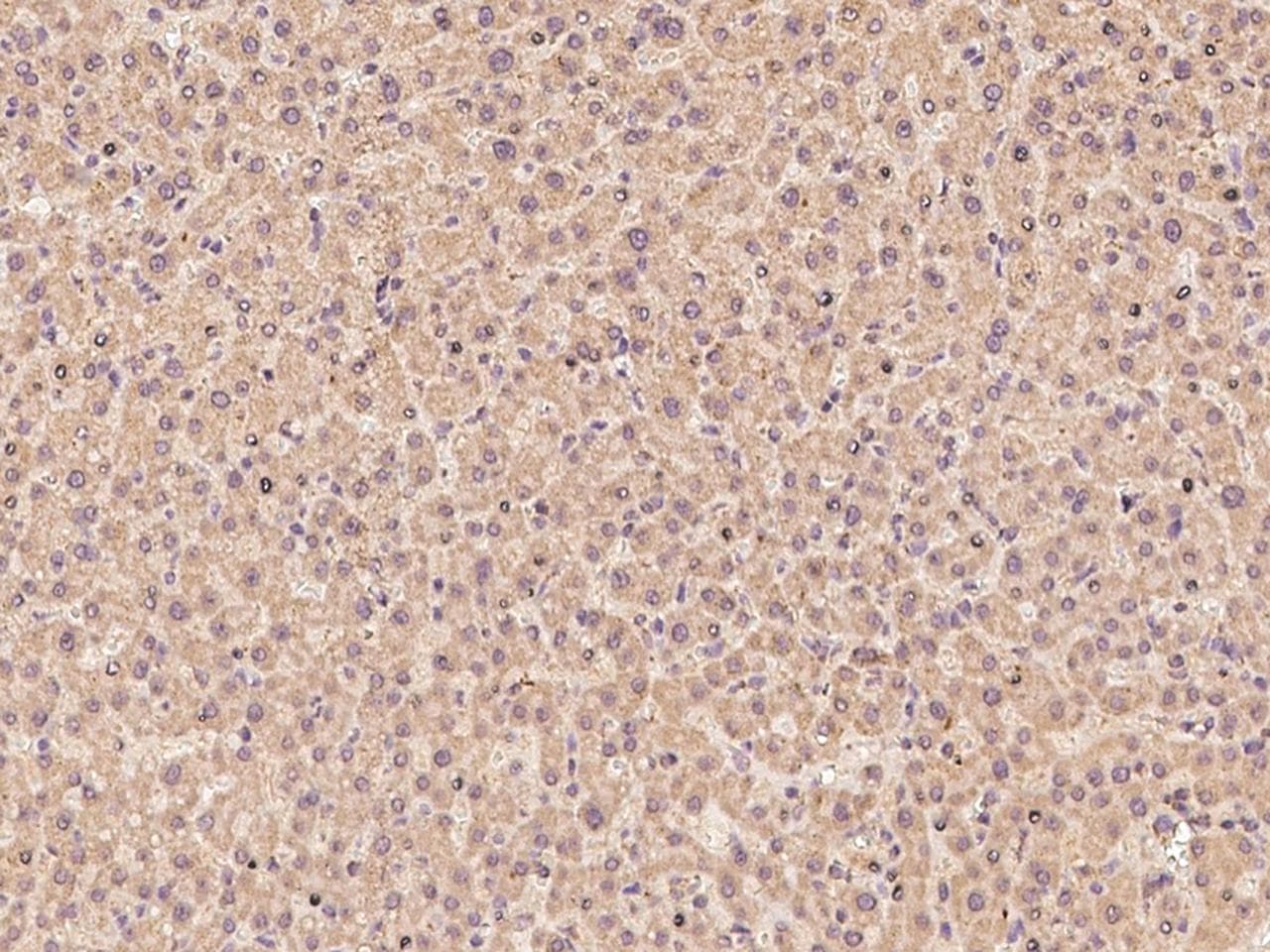 ZNF100 Antibody