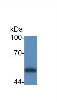 CALR / Calreticulin Antibody (aa18-193)