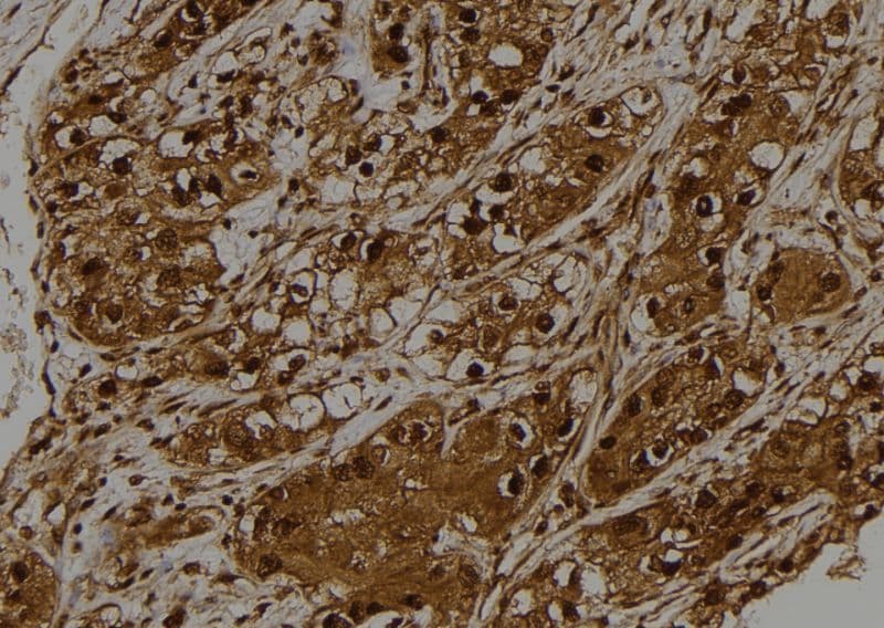 STK32C / PKE Antibody