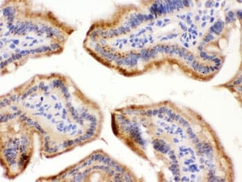 FUT1 / HSC Antibody