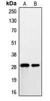 PSCA Antibody (Internal)