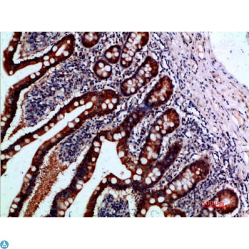 Polyclonal Rabbit anti-Human IL37 Antibody (IHC)