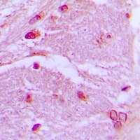 CSRP1 Antibody (Internal)
