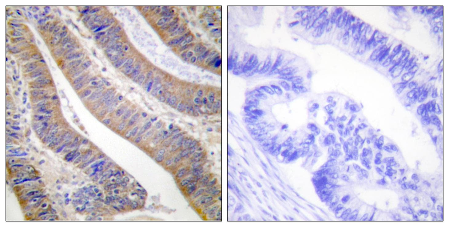 NCF1 / p47phox / p47 phox Antibody (p359)