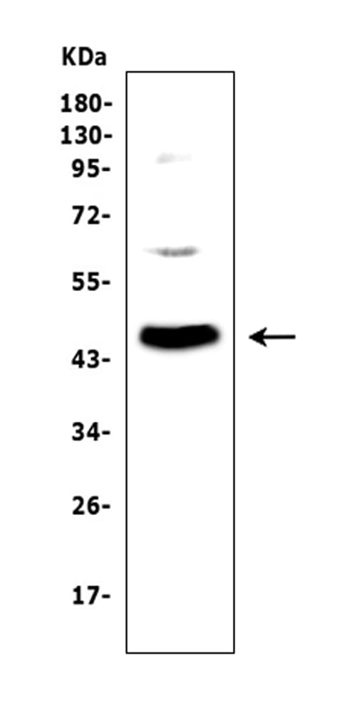 Polyclonal Rabbit anti-Rat ADA / Adenosine Deaminase Antibody (IHC, WB)