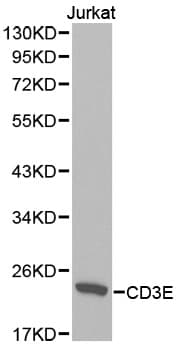 Polyclonal Rabbit anti-Human CD3E Antibody (IHC, IF, WB)
