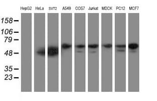 Monoclonal Mouse anti-Human NONO / P54NRB Antibody (clone OTI3G4, aa184-385, WB)