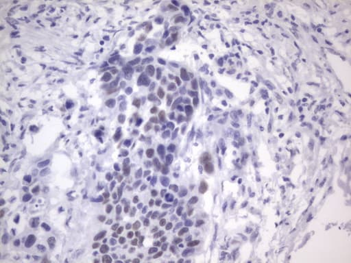 ER Alpha / Estrogen Receptor Antibody (aa1-310, clone OTI2D3)