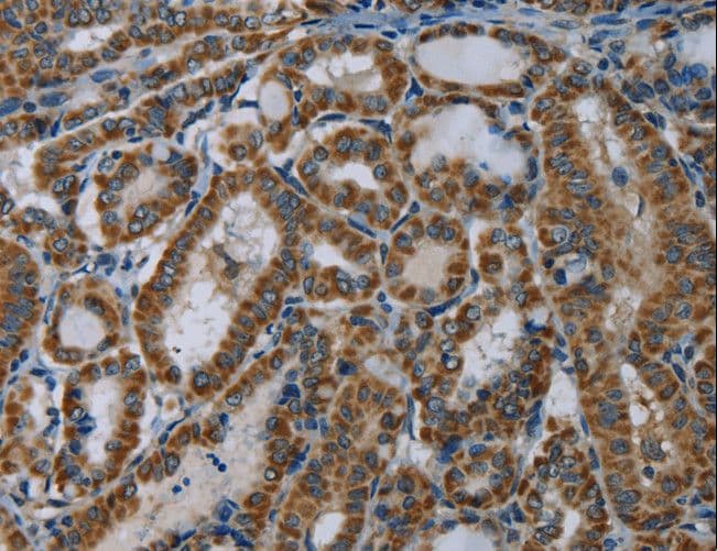 NDUFA5 Antibody