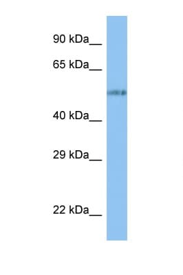 Polyclonal Rabbit anti-Human VANGL1 Antibody (N-Terminus, WB)