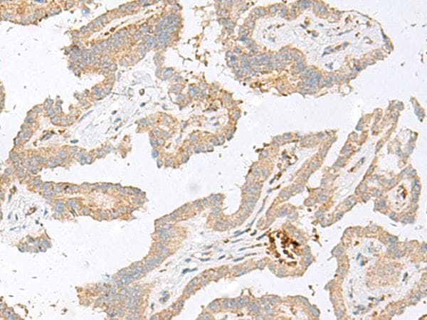 Polyclonal Rabbit anti-Human Hemoglobin Gamma (HBG1 + HBG2) Antibody (IHC, WB)