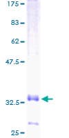 Human CCL20 / MIP-3-Alpha Protein (Recombinant GST)