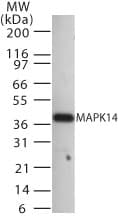 IHC-plus™ Polyclonal Rabbit anti-Human MAPK14 / p38 Antibody (IHC, WB)