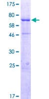 Human WDR19 Protein (Recombinant GST)