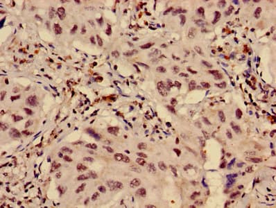 Polyclonal Rabbit anti-Human HIST1H3A Antibody (IHC, IF, WB)
