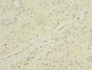 Polyclonal Rabbit anti-Human MGAT / GLYT1 Antibody (IHC)