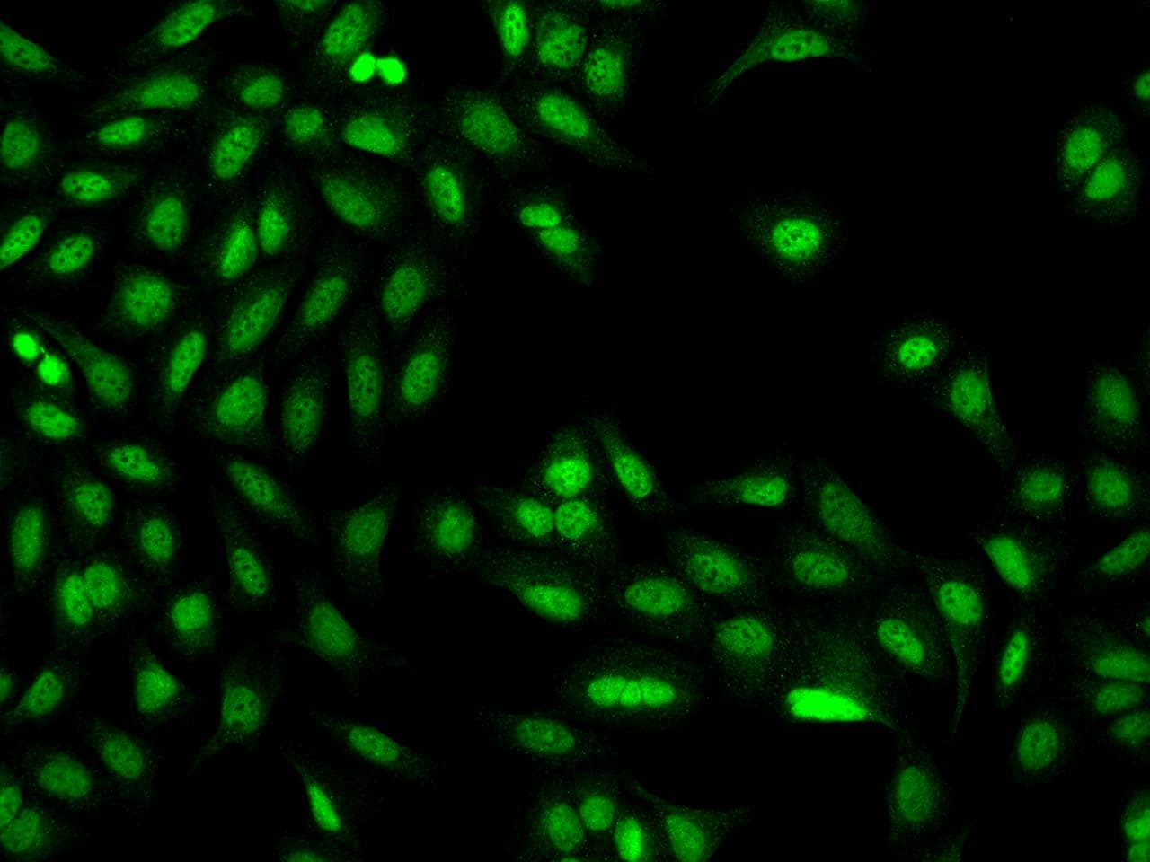 Polyclonal Rabbit anti-Human CD20 Antibody (IHC, IF)