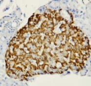 FABP1 / L-FABP Antibody (N-Terminus)