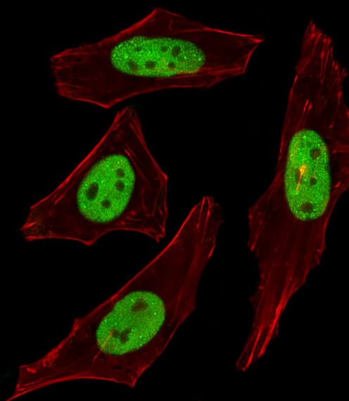IHC-plus™ SUMO2 + SUMO3 Antibody (aa49-81)