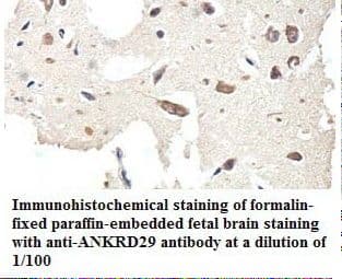 Polyclonal Rabbit anti-Human ANKRD29 Antibody (aa79-299, IHC, WB)