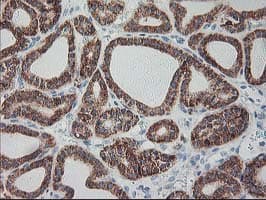 RPN1 / Ribophorin I Antibody (clone OTI2E3)