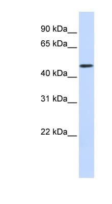 Polyclonal Rabbit anti-Human WDR21A / DCAF4 Antibody (aa216-265, WB)