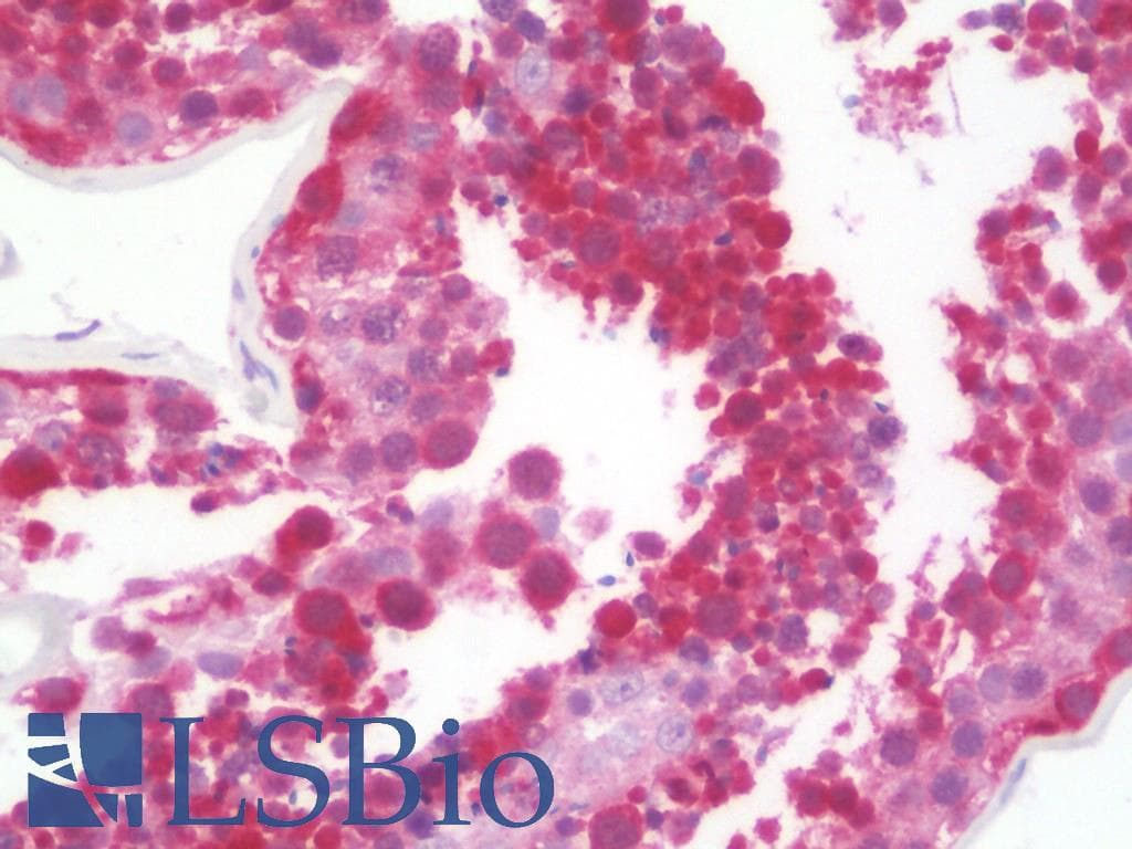IHC-plus™ ABHD2 Antibody (aa251-300)