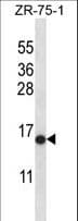 IHC-plus™ HIST2H2AB Antibody (aa1-30)