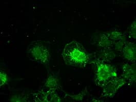 TYRO3 Antibody (clone OTI9B12)