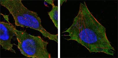 S100A10 Antibody (clone 4E7E10)