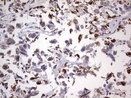 Monoclonal Mouse anti-Human PPP2R5D Antibody (clone OTI5E7, IHC, WB)